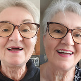 Blunko™ – Moldable Dentures