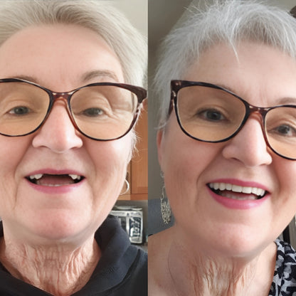 Blunko™ – Moldable Dentures