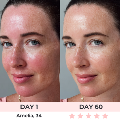 Blunko™- LED Face Mask